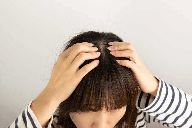 頭皮が気になり、頭を触る女性
