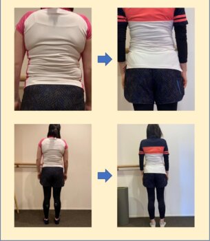 結果的にダイエットで14㎏痩せた女性