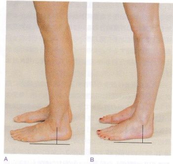足首の硬さが半張膝の原因になります