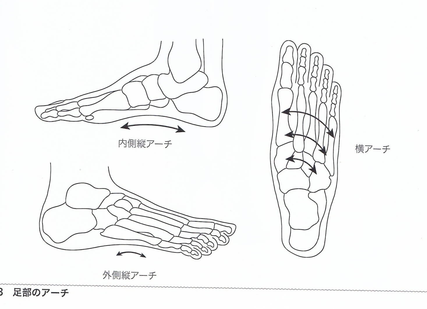 足部の内、外側アーチと横アーチは安定した歩行のためには重要です。