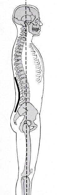 腰椎の前彎は歩行時に大切