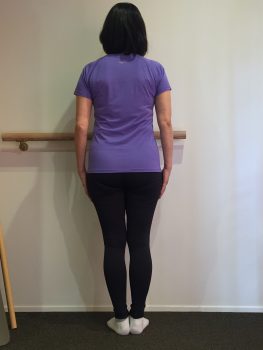 ダイエット前の体全体が弛んでいる状態のクライアント女性